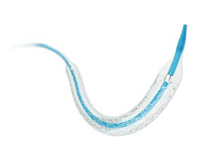 Partner®Sirolimus-eluting Coronary Stent System