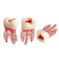 Root Canal Models