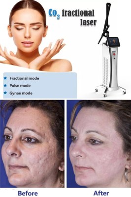 Fractional CO2 laser resurfacing overview