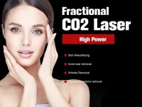 What can you expect before and after CO2 laser treatment
