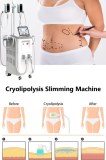 What can you expect from a cryolipolysis session?