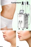 Everything you need to know about Cryolipolysis fat freezing