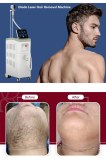 Diode laser hair removal - a step by step process