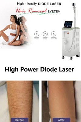 All About Diode Laser Treatment: What You Need To Know