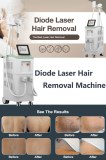 What are the benefits if diode laser hair removal?