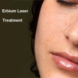 Erbium laser gives your skin a second chance