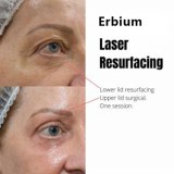Overview of Erbium laser skin resurfacing