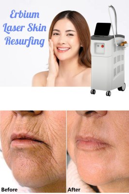 Understanding Erbium Laser Skin Resurfacing