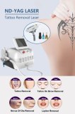 Get to know the Q-switched ND YAG laser technology that removal tattoos