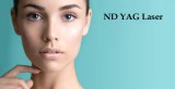 The Q-Switched ND YAG Laser Effectively Treats Tattoos