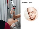 Picosecond Laser treatment for skin revitalization FAQs