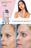 IPL treatment target your specific skin problems