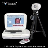 Ykd-3003 Colposcopio digital portátil con la cámara a la Clínica
