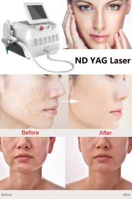 Láser Nd YAG para el tratamiento estético de pacientes con trastornos cutáneos pigmentados